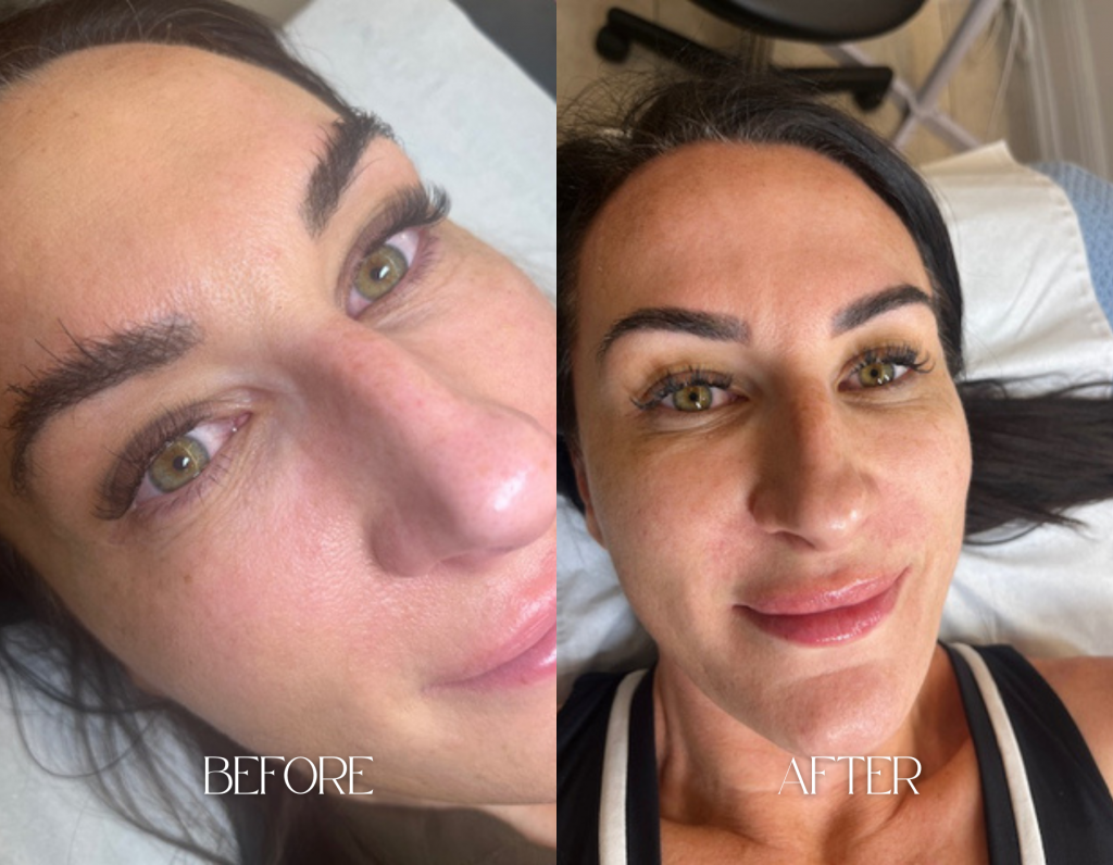 microblading-before-and-after-benefits-of-semi-permanent-makeup-navs-beauty